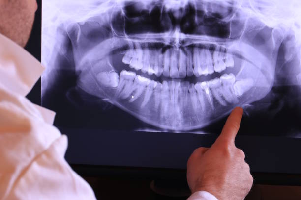 Best Knocked-Out Tooth Emergency  in Toppenish, WA