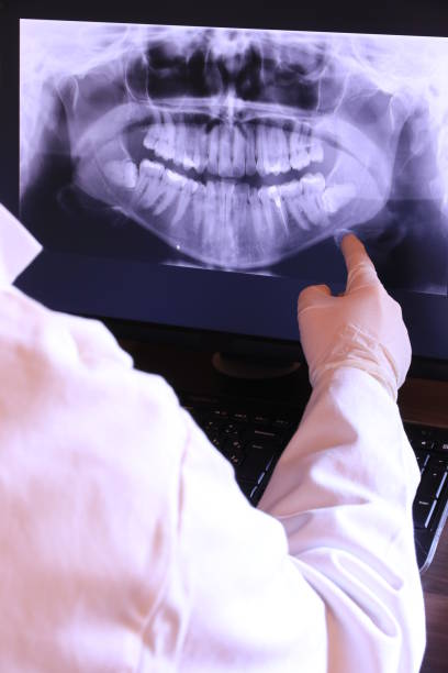 Best Knocked-Out Tooth Emergency  in Toppenish, WA