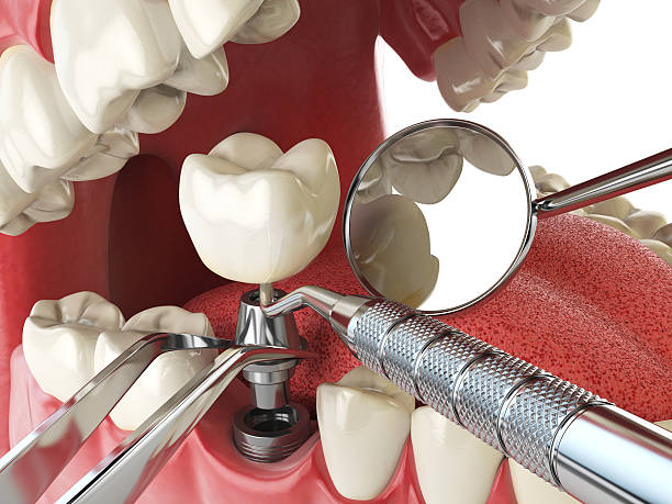 Best Broken Tooth Emergency  in Toppenish, WA